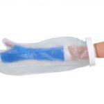 Gipshoes halve arm - volwassene